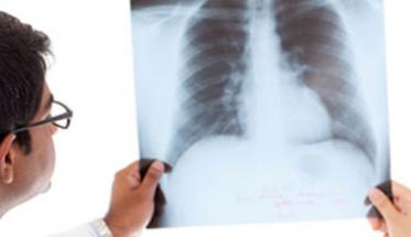 Pulmonary Medicine (TB & Chest)